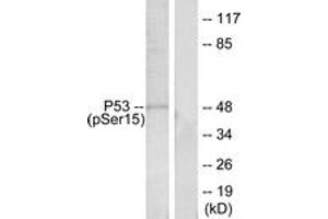Western blot analysis of extracts from HeLa cells treated with HU, using p53 (Phospho-Ser15) Antibody. (p53 抗体  (pSer15))
