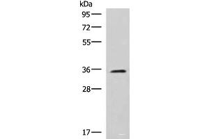 Western blot analysis of K562 cell lysate using JAM3 Polyclonal Antibody at dilution of 1:1000 (JAM3 抗体)