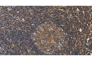 Immunohistochemistry of paraffin-embedded Human tonsil tissue using RAD54L2 Polyclonal Antibody at dilution 1:40 (ARIP4 抗体)