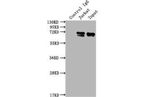 Western Blotting (WB) image for anti-Far Upstream Element (FUSE) Binding Protein 1 (FUBP1) antibody (ABIN7127503)