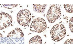 Immunohistochemistry of paraffin-embedded Mouse testis tissue using EFHD1 Monoclonal Antibody at dilution of 1:200. (EFHD1 抗体)