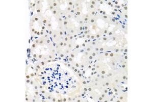 Immunohistochemistry of paraffin-embedded mouse kidney using THOC1 antibody (ABIN5974800) at dilution of 1/100 (40x lens). (THOC1 抗体)