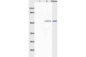 SDS-PAGE (SDS) image for anti-Cytochrome P450, Family 11, Subfamily A, Polypeptide 1 (CYP11A1) (AA 321-420) antibody (ABIN701530)