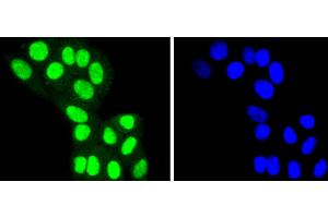 HepG2 cells were stained with HDAC8 (4C3) Monoclonal Antibody  at [1:200] incubated overnight at 4C, followed by secondary antibody incubation, DAPI staining of the nuclei and detection. (HDAC8 抗体)