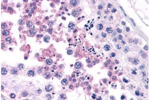 Human Testis (formalin-fixed, paraffin-embedded) stained with CAMP antibody ABIN343893 at 5 ug/ml followed by biotinylated goat anti-rabbit IgG secondary antibody ABIN481713, alkaline phosphatase-streptavidin and chromogen. (Cathelicidin 抗体  (C-Term))