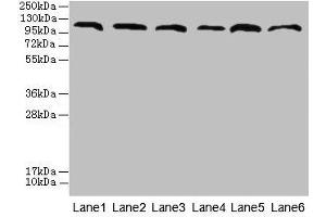 Western blot All lanes: CATSPERE antibody at 6 μg/mL Lane 1: U87 whole cell lysate Lane 2: HepG2 whole cell lysate Lane 3: A549 whole cell lysate Lane 4: Mouse lung tissue Lane 5: Mouse liver tissue Lane 6: PC-3 whole cell lysate Secondary Goat polyclonal to rabbit IgG at 1/10000 dilution Predicted band size: 110, 96, 93 kDa Observed band size: 110 kDa (Cation Channel Sperm-Associated Protein Subunit epsilon (CATSPERE) (AA 601-832) 抗体)