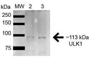 Western blot analysis of Rat Brain cell lysates showing detection of ~112. (ULK1 抗体  (AA 567-577) (APC))