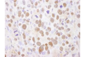 Immunohistochemistry (IHC) image for anti-Proteasome Subunit alpha 2 (PSMA2) (AA 184-234) antibody (ABIN7454564)