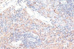 Immunohistochemistry of paraffin-embedded rat spleen using CD274 Antibody (ABIN6291806) at dilution of 1:100 (40x lens). (PD-L1 抗体)