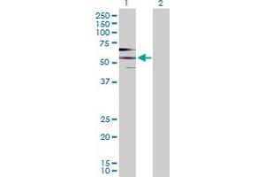 Western Blot analysis of PDE9A expression in transfected 293T cell line by PDE9A MaxPab polyclonal antibody. (PDE9A 抗体  (AA 1-533))