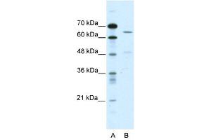 ACCN1 antibody used at 2 ug/ml to detect target protein. (ACCN1 抗体)
