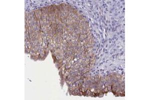 Immunohistochemical staining of human urinary bladder with TACSTD2 polyclonal antibody  shows moderate membranous positivity in urothelial cells.