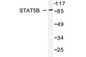 Western blot analysis of Stat5b antibody in extracts from HeLa cells. (STAT5B 抗体)