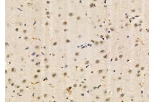 ABIN6260309 and ABIN6273995 at 1/100 staining Rat brain tissue by IHC-P. (BRD4 抗体  (N-Term))