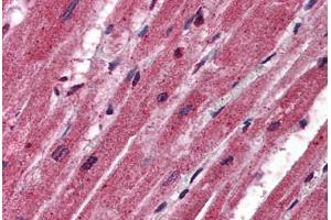 Human Heart: Formalin-Fixed, Paraffin-Embedded (FFPE) (CPN1 抗体  (AA 251-300))