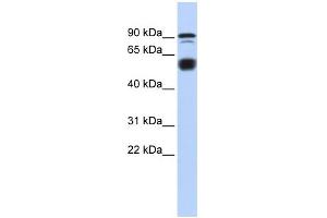 WB Suggested Anti-BCL11A Antibody Titration:  0. (BCL11A 抗体  (N-Term))