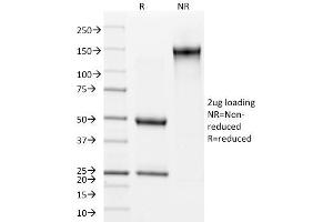 SDS-PAGE Analysis Purified Involucrin Mouse Monoclonal Antibody (SY5). (Involucrin 抗体)