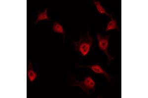 Immunofluorescence (fixed cells) (IF/ICC) image for anti-Zinc Finger CCCH-Type Containing 7B (ZC3H7B) (C-Term) antibody (ABIN6258361)