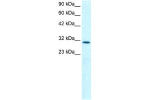 WB Suggested Anti-KLF8 Antibody Titration: 0. (KLF8 抗体  (N-Term))