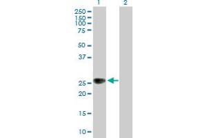 Western Blot analysis of ZNRF1 expression in transfected 293T cell line by ZNRF1 MaxPab polyclonal antibody. (ZNRF1 抗体  (AA 1-227))