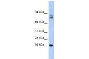 Image no. 1 for anti-Myotrophin (MTPN) (AA 35-84) antibody (ABIN6743678) (MTPN 抗体  (AA 35-84))