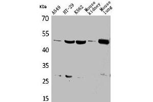 Western Blot analysis of A549 HT29 K562 mouse kidney mouse lung cells using GDI-2 Polyclonal Antibody (GDI2 抗体  (C-Term))