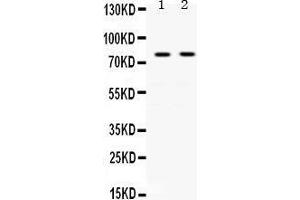 Observed bind size: 77KD (Transferrin 抗体  (N-Term))