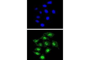 Immunofluorescence (IF) image for anti-Core-Binding Factor, beta Subunit (CBFB) antibody (ABIN3002868) (CBFB 抗体)