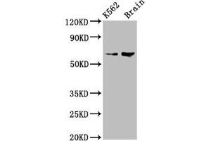Western Blot Positive WB detected in: K562 whole cell lysate, Rat brain tissue All lanes: BRAP antibody at 7. (BRAP 抗体  (AA 13-124))