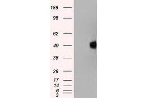 Western Blotting (WB) image for anti-Neurotrophic Tyrosine Kinase, Receptor, Type 2 (NTRK2) antibody (ABIN2734330)