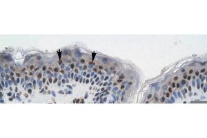 Rabbit Anti-GTF21 Antibody ,Paraffin Embedded Tissue: Human Skin  Cellular Data: Squamous epithelial cells  Antibody Concentration: 4. (GTF2I 抗体  (N-Term))