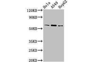 Western Blot Positive WB detected in: Hela whole cell lysate, A549 whole cell lysate, HepG2 whole cell lysate All lanes: TBL1X antibody at 3 μg/mL Secondary Goat polyclonal to rabbit IgG at 1/50000 dilution Predicted band size: 63, 58 kDa Observed band size: 63 kDa (TBL1X 抗体  (AA 1-300))