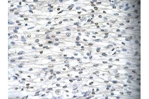 Immunohistochemistry (IHC) image for anti-Sirtuin 5 (SIRT5) (Middle Region) antibody (ABIN2779613)