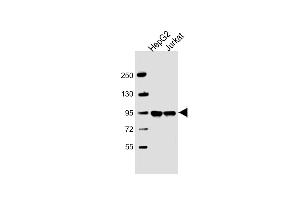 All lanes : Anti-FIBP1 Antibody (Center) at 1:2000 dilution Lane 1: HepG2 whole cell lysate Lane 2: Jurkat whole cell lysate Lysates/proteins at 20 μg per lane. (PPFIBP1 抗体  (AA 588-617))