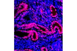 Immunofluorescence (Paraffin-embedded Sections) (IF (p)) image for anti-General Transcription Factor IIIC, Polypeptide 2, beta 110kDa (GTF3C2) antibody (ABIN7074038)