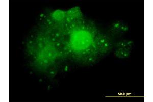 Immunofluorescence of monoclonal antibody to ALDOA on A-431 cell. (ALDOA 抗体  (AA 1-364))