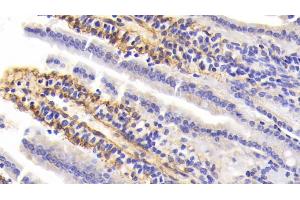 Detection of PIIINP in Mouse Small Intestine Tissue using Polyclonal Antibody to Procollagen III N-Terminal Propeptide (PIIINP) (PIIINP 抗体  (AA 24-154))