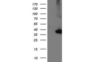 Western Blotting (WB) image for anti-Nudix (Nucleoside Diphosphate Linked Moiety X)-Type Motif 18 (NUDT18) antibody (ABIN1499862) (NUDT18 抗体)