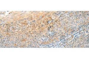 Immunohistochemistry (Paraffin-embedded Sections) (IHC (p)) image for anti-C-Type Lectin Domain Family 3, Member B (CLEC3B) antibody (ABIN7246511)