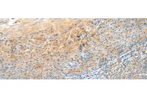 Immunohistochemistry of paraffin-embedded Human tonsil tissue using CLEC3B Polyclonal Antibody at dilution of 1:90(x200) (CLEC3B 抗体)