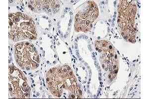 Immunohistochemical staining of paraffin-embedded Human Kidney tissue using anti-ACY1 mouse monoclonal antibody. (Aminoacylase 1 抗体)