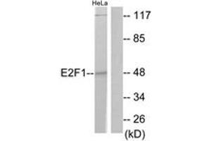 Western blot analysis of extracts from HeLa cells, treated with Etoposide 25uM 24h, using E2F1 (Ab-433) Antibody. (E2F1 抗体  (AA 388-437))