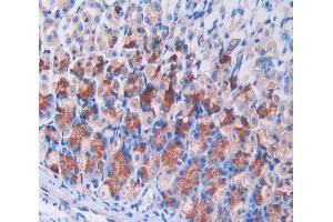 IHC-P analysis of stomach tissue, with DAB staining. (IL2RG 抗体  (AA 23-263))