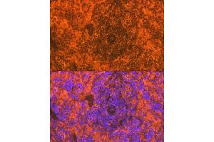 Immunofluorescence analysis of rat spleen using CD83 Rabbit mAb (ABIN7266223) at dilution of 1:100 (40x lens). (CD83 抗体)