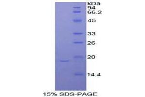 SDS-PAGE (SDS) image for Periostin (POSTN) (AA 659-810) protein (His tag) (ABIN1981201)