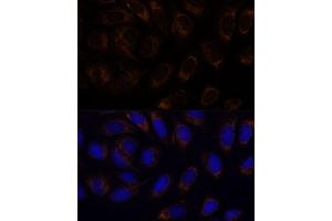 Immunofluorescence analysis of U-2 OS cells using R antibody (ABIN6132582, ABIN6146672, ABIN6146673 and ABIN6222096) at dilution of 1:100. (RAMP1 抗体  (AA 27-117))