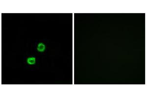 Immunofluorescence analysis of MCF-7 cells, using GCNT7 antibody. (GCNT7 抗体  (C-Term))