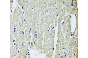 Immunohistochemistry of paraffin-embedded Rat heart using SLC5A6 Polyclonal Antibody at dilution of 1:100 (40x lens). (SLC5A6 抗体)