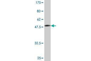 Western Blot detection against Immunogen (53. (TPI1 抗体  (AA 1-249))