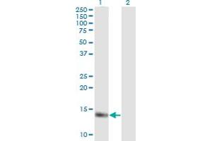 Western Blotting (WB) image for anti-Myoglobin (MB) (AA 2-100) antibody (ABIN517756)